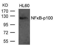 Anti-NFkB p100 antibody used in Western Blot (WB). GTX50376