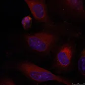 Anti-JunB antibody used in Immunocytochemistry/ Immunofluorescence (ICC/IF). GTX50386