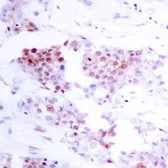 Anti-MEF2A antibody used in IHC (Paraffin sections) (IHC-P). GTX50398