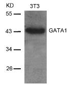 Anti-GATA1 antibody used in Western Blot (WB). GTX50399
