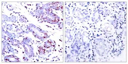 Anti-STAT1 antibody used in IHC (Paraffin sections) (IHC-P). GTX50401