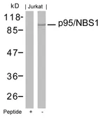 Anti-NBS1 antibody used in Western Blot (WB). GTX50412