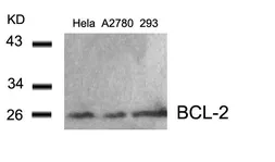 Anti-Bcl-2 antibody used in Western Blot (WB). GTX50413