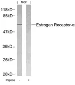 Anti-Estrogen Receptor alpha antibody used in Western Blot (WB). GTX50420