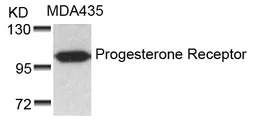 Anti-Progesterone Receptor antibody used in Western Blot (WB). GTX50422