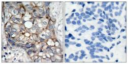 Anti-EGFR antibody used in IHC (Paraffin sections) (IHC-P). GTX50426