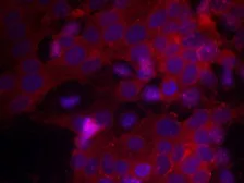 Anti-IGF1R antibody used in Immunocytochemistry/ Immunofluorescence (ICC/IF). GTX50433
