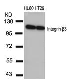 Anti-Integrin beta 3 antibody used in Western Blot (WB). GTX50435