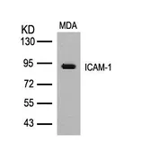 Anti-ICAM1 / CD54 antibody used in Western Blot (WB). GTX50456