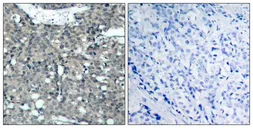 Anti-Paxillin antibody used in IHC (Paraffin sections) (IHC-P). GTX50457