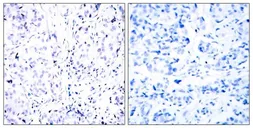 Anti-Rb antibody used in IHC (Paraffin sections) (IHC-P). GTX50459