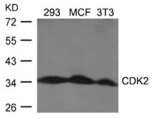 Anti-CDK2 antibody used in Western Blot (WB). GTX50461