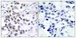 Anti-Chk1 antibody used in IHC (Paraffin sections) (IHC-P). GTX50463