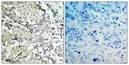 Anti-MEK3 antibody used in IHC (Paraffin sections) (IHC-P). GTX50464