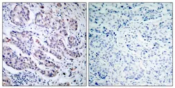Anti-TYK2 antibody used in IHC (Paraffin sections) (IHC-P). GTX50465