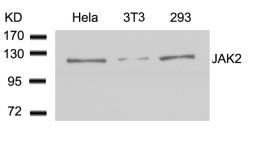 Anti-JAK2 antibody used in Western Blot (WB). GTX50467
