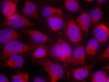 Anti-ASK1 antibody used in Immunocytochemistry/ Immunofluorescence (ICC/IF). GTX50471