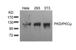 Anti-PKC mu antibody used in Western Blot (WB). GTX50473