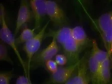 Anti-FAK antibody used in Immunocytochemistry/ Immunofluorescence (ICC/IF). GTX50489