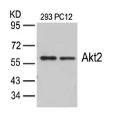 Anti-AKT2 antibody used in Western Blot (WB). GTX50494