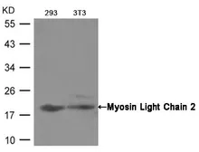 Anti-Myosin Light Chain 2 antibody used in Western Blot (WB). GTX50495