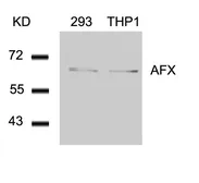 Anti-FOXO4 antibody used in Western Blot (WB). GTX50500
