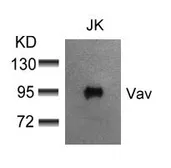 Anti-VAV1 antibody used in Western Blot (WB). GTX50503