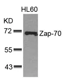 Anti-ZAP70 antibody used in Western Blot (WB). GTX50508