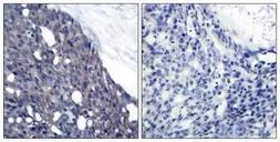 Anti-IKB alpha antibody used in IHC (Paraffin sections) (IHC-P). GTX50510
