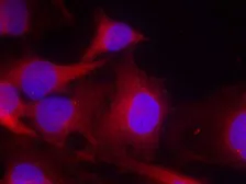 Anti-PLCG2 antibody used in Immunocytochemistry/ Immunofluorescence (ICC/IF). GTX50517