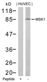 Anti-MSK1 antibody used in Western Blot (WB). GTX50527