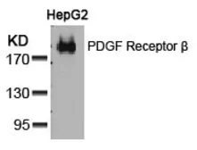 Anti-PDGF Receptor beta antibody used in Western Blot (WB). GTX50546