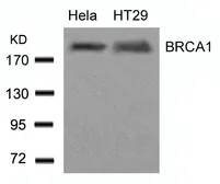 Anti-BRCA1 antibody used in Western Blot (WB). GTX50557