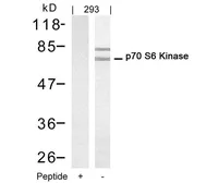 Anti-p70 S6K antibody used in Western Blot (WB). GTX50567