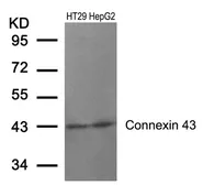 Anti-Connexin 43 antibody used in Western Blot (WB). GTX50571