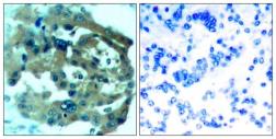 Anti-Merlin antibody used in IHC (Paraffin sections) (IHC-P). GTX50579