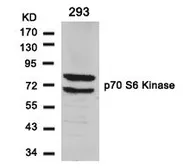Anti-p70 S6K antibody used in Western Blot (WB). GTX50582