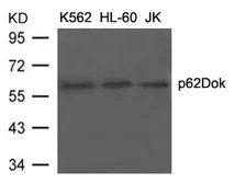 Anti-p62Dok antibody used in Western Blot (WB). GTX50588