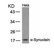 Anti-alpha Synuclein antibody used in Western Blot (WB). GTX50595