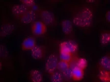 Anti-PKC delta antibody used in Immunocytochemistry/ Immunofluorescence (ICC/IF). GTX50605
