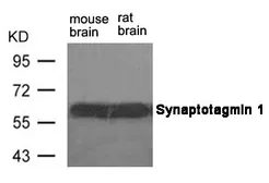 Anti-Synaptotagmin 1 antibody used in Western Blot (WB). GTX50608