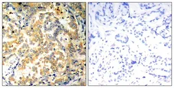 Anti-NFkB p100 antibody used in IHC (Paraffin sections) (IHC-P). GTX50610