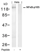 Anti-NFkB p105 antibody used in Western Blot (WB). GTX50618