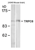 Anti-TRPC6 antibody used in Western Blot (WB). GTX50636