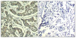 Anti-ATR antibody used in IHC (Paraffin sections) (IHC-P). GTX50649