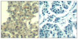 Anti-Her3 / ErbB3 antibody used in IHC (Paraffin sections) (IHC-P). GTX50651