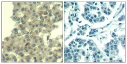 Anti-Her3 / ErbB3 antibody used in IHC (Paraffin sections) (IHC-P). GTX50651