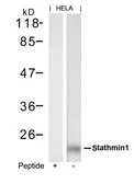 Anti-Stathmin 1 antibody used in Western Blot (WB). GTX50655