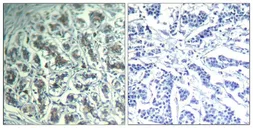 Anti-PLCG1 antibody used in IHC (Paraffin sections) (IHC-P). GTX50658
