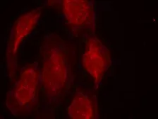 Anti-CDK6 antibody used in Immunocytochemistry/ Immunofluorescence (ICC/IF). GTX50664